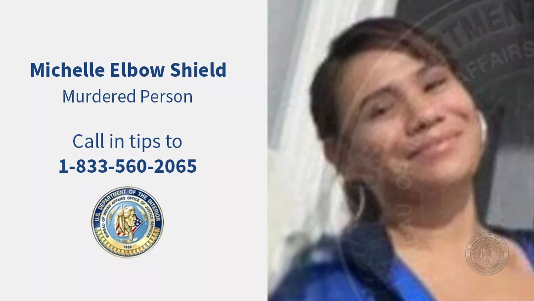 Michelle Elbow Shield