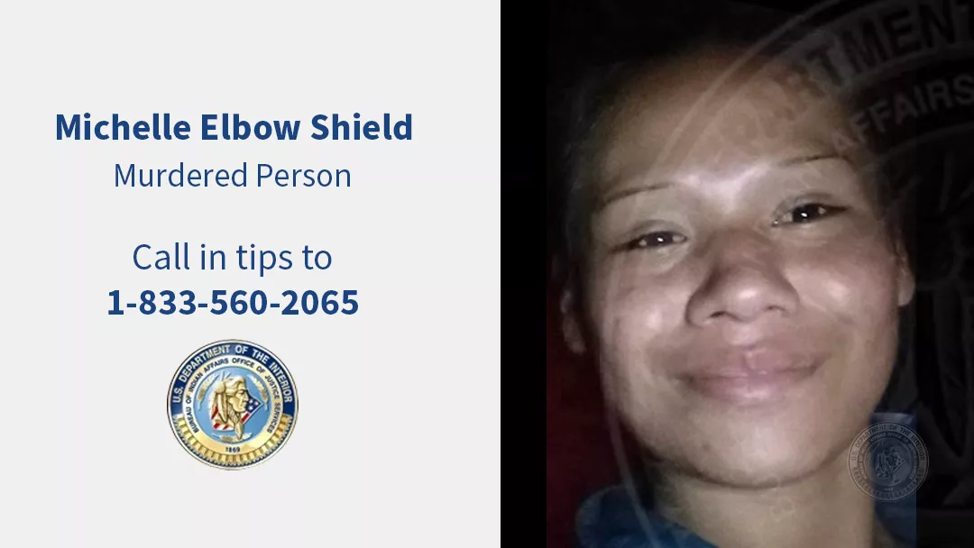 Michelle Elbow Shield
